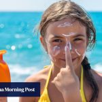 How sunburn in children can lead to skin cancer in later life. These tips can protect them