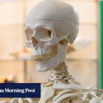 Why your bones could be a key to better brain health and becoming a ‘super-ager’
