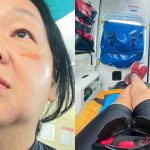 Cyclist blacks out after Grab driver’s illegal turn, says driver demanded repair costs while she was in A&E, Singapore News