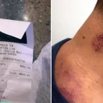 Tourist claims TCM clinic upsold treatments in Singapore