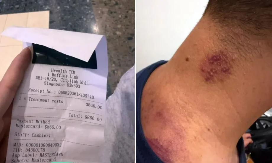 Tourist claims TCM clinic upsold treatments in Singapore Tourist claims TCM clinic upsold treatments in Singapore