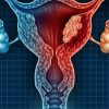 DKSH Launches Colpofix in Singapore to Support Women with HPV-Related Cervical Lesions