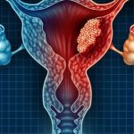 DKSH Launches Colpofix in Singapore to Support Women with HPV-Related Cervical Lesions