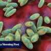The plague isn’t history. Where it still exists, how it spreads and a cure