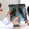 Lung cancer rising among never-smokers; role of PM2.5 exposure being studied: Ong Ye Kung, Singapore News
