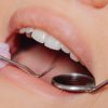 Singapore woman warns against going JB for dental work after face swells: ‘Not worth it just to save money’, Singapore News