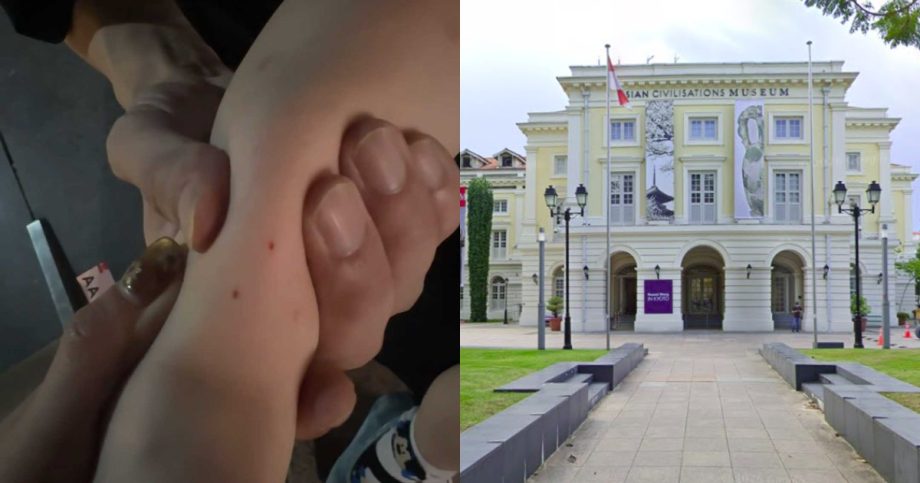 Toddler bitten by snake outside Asian Civilisations Museum, taken to hospital, Singapore News Toddler bitten by snake outside Asian Civilisations Museum, taken to hospital, Singapore News